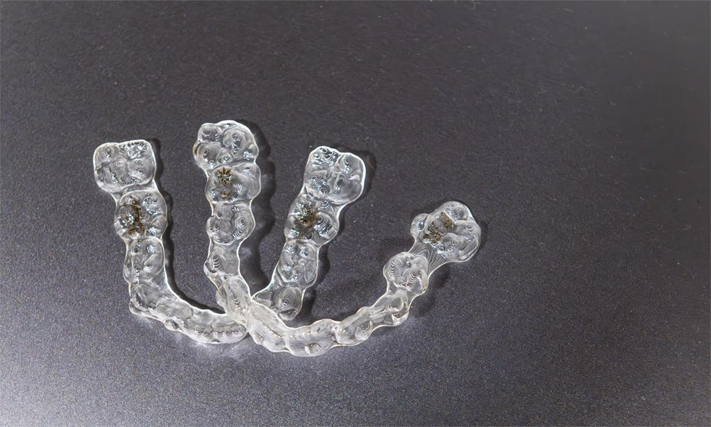 5 puntos que diferencian a Invisalign de otras alternativas de ortodoncia
