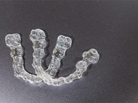 5 puntos que diferencian a Invisalign de otras alternativas de ortodoncia