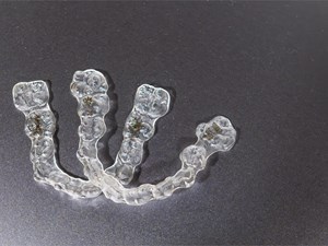 5 puntos que diferencian a Invisalign de otras alternativas de ortodoncia