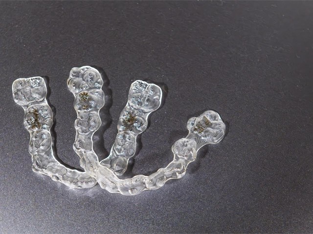 5 puntos que diferencian a Invisalign de otras alternativas de ortodoncia