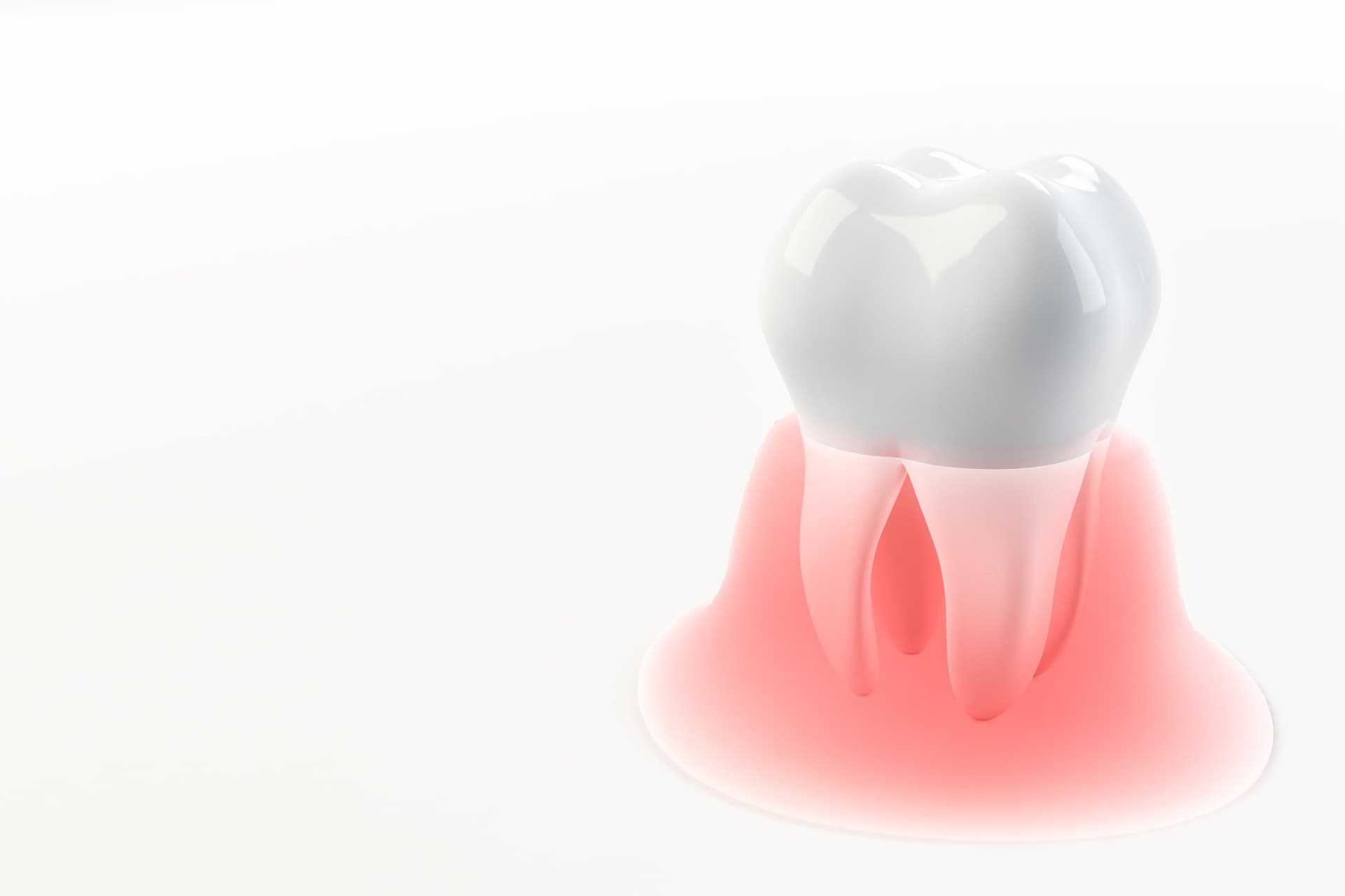 Tratamiento periodontal en Baiona