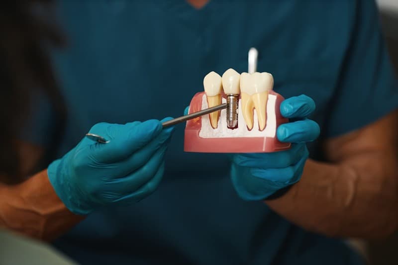 Implantes dentales en Baiona