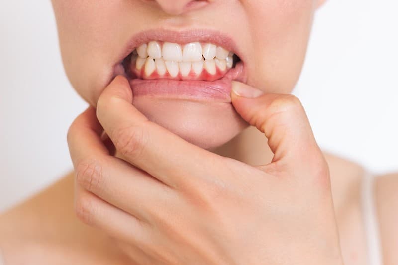 Periodoncia en Baiona