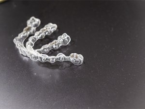 La ortodoncia invisible: más que estética, ¿cómo mejora tu salud bucal?