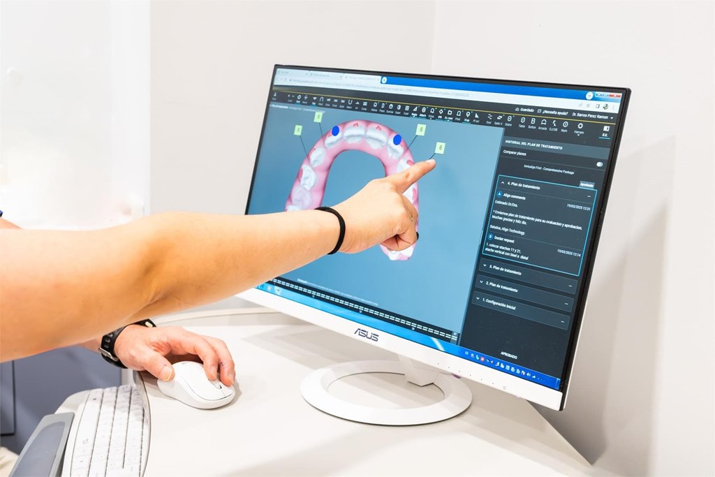 Mitos y verdades sobre los implantes dentales